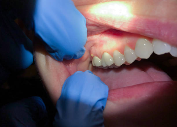 Best Cosmetic Emergency Dentistry in Victoria, MS